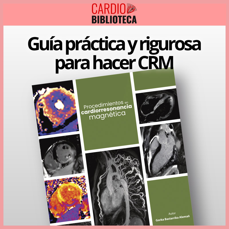 Procedimientos en CRM