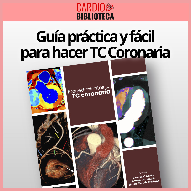 Procedimientos en TC coronaria