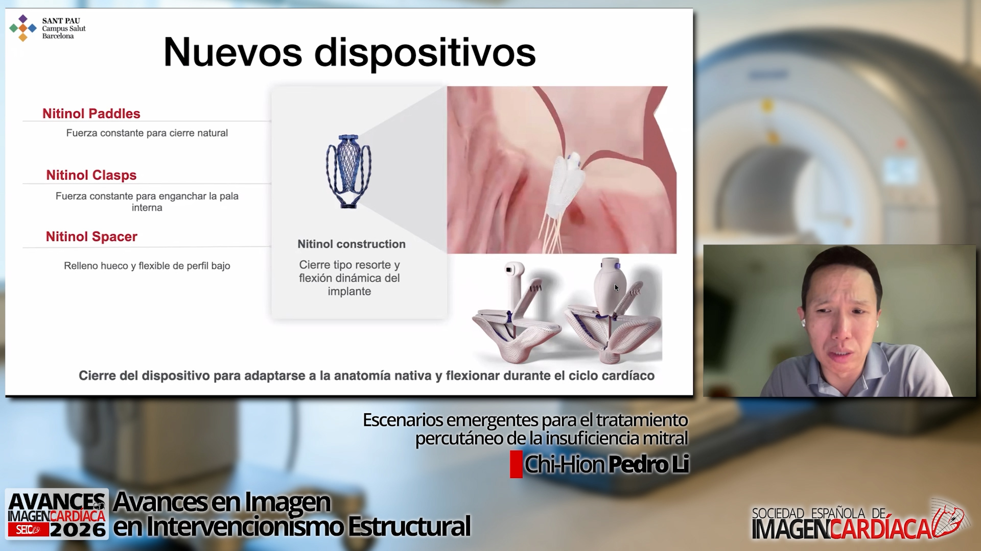 Intervencionismo mitral en 2026