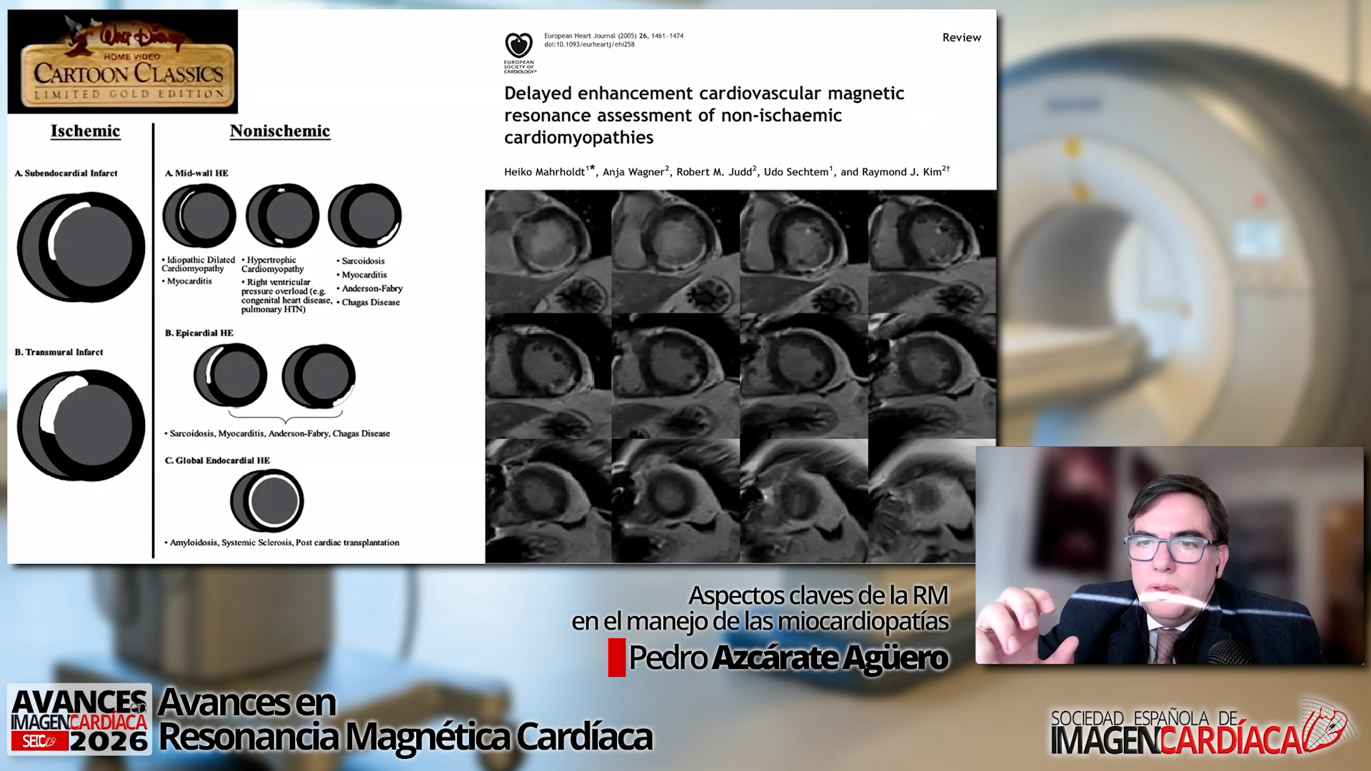 Aspectos claves de la RM en el manejo de las miocardiopatías