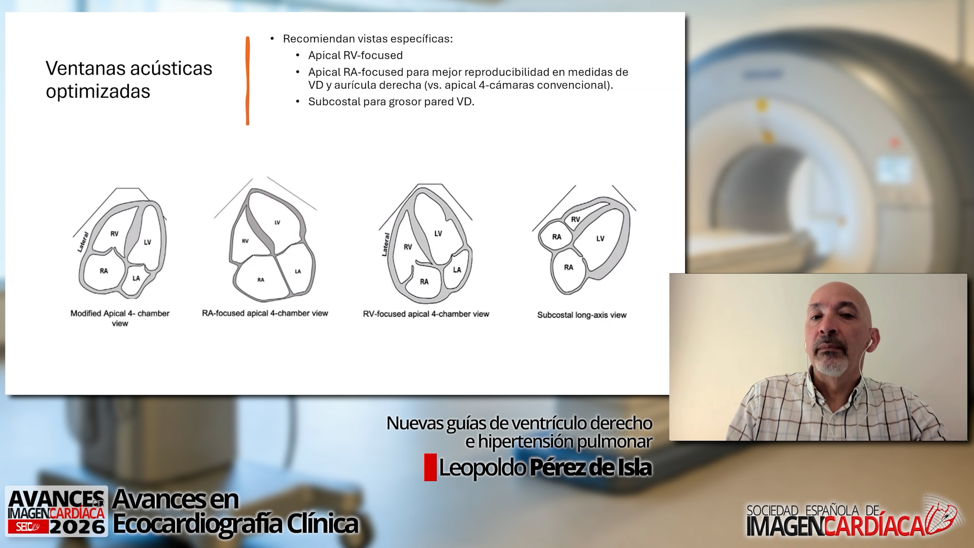 Nuevas guías de ventrículo derecho e hipertensión pulmonar