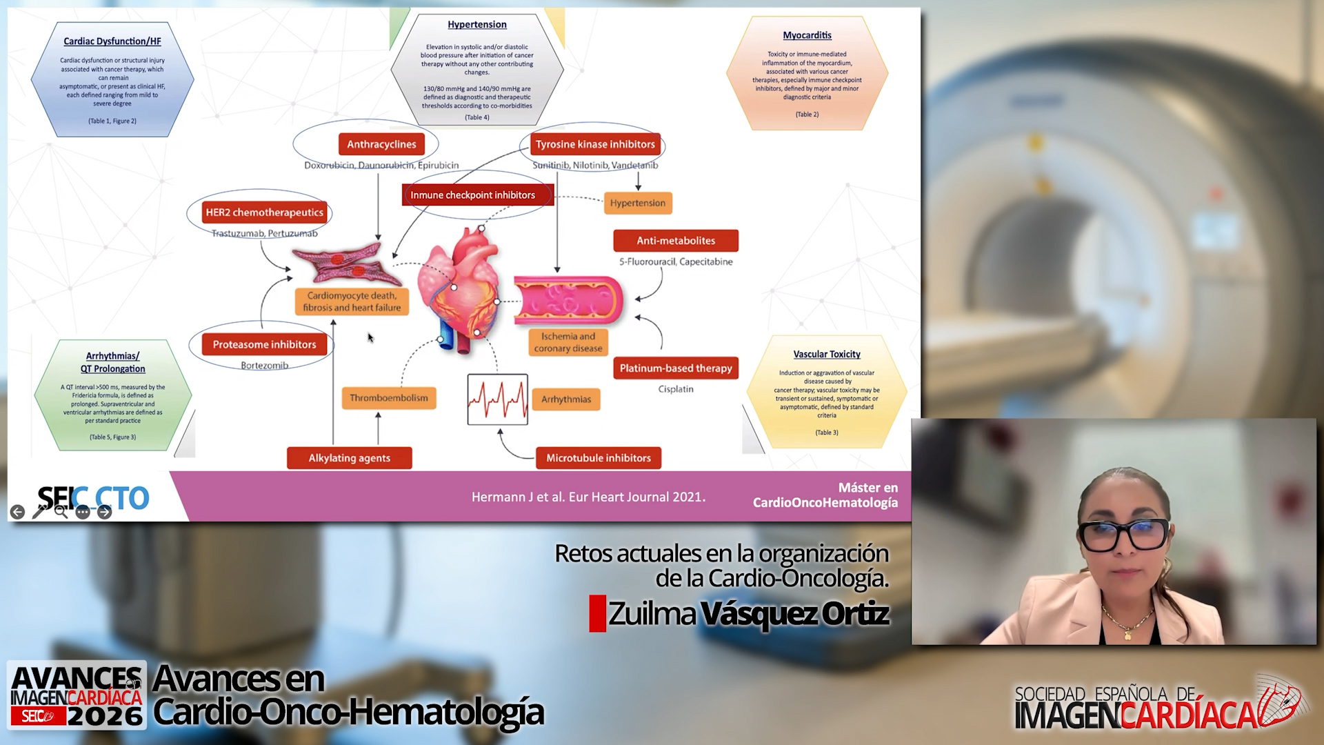 Retos actuales en la organización de la Cardio-Oncología