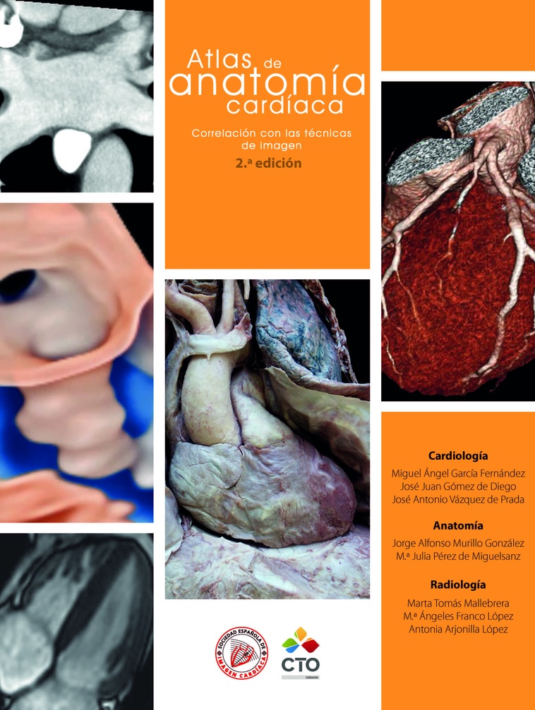 Atlas de anatomía cardíaca - Portada