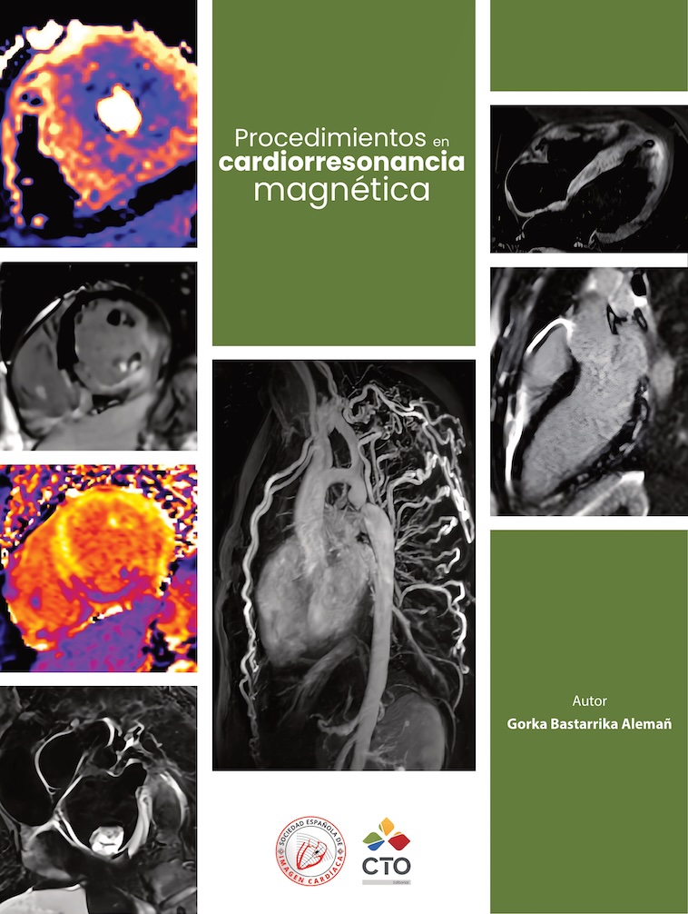 Procedimientos en cardiorresonancia magnética - Portada