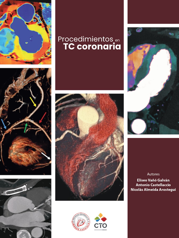 Procedimientos en TC coronaria - Portada