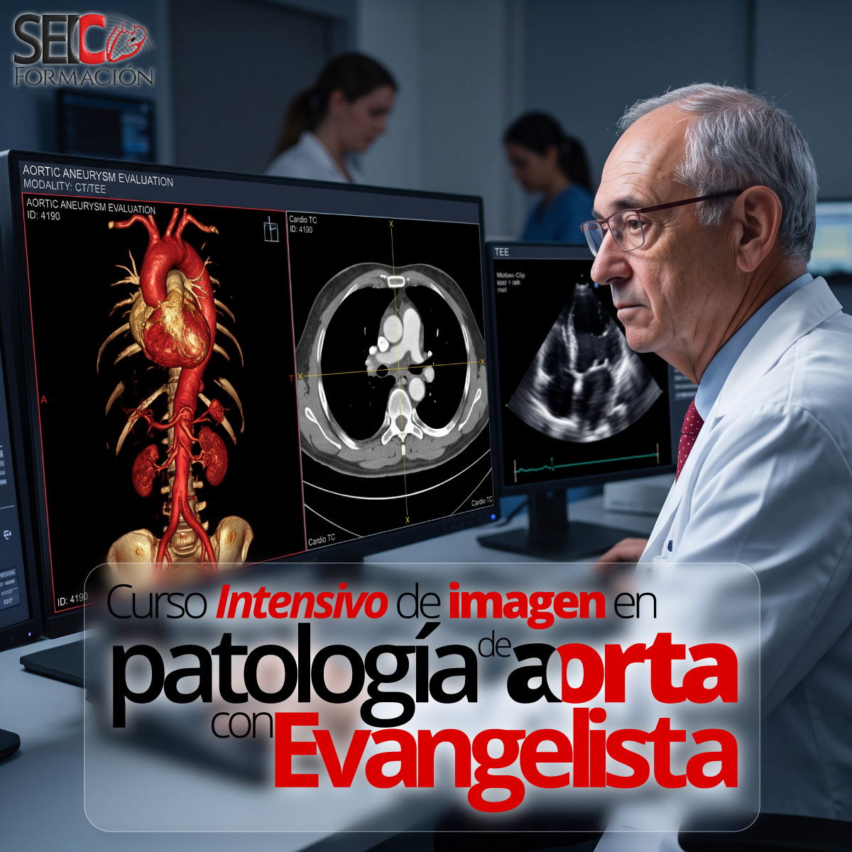 Curso Intensivo de Imagen en Patología de Aorta con Evangelista Curso Intensivo de Imagen en Patología de Aorta con Evangelista