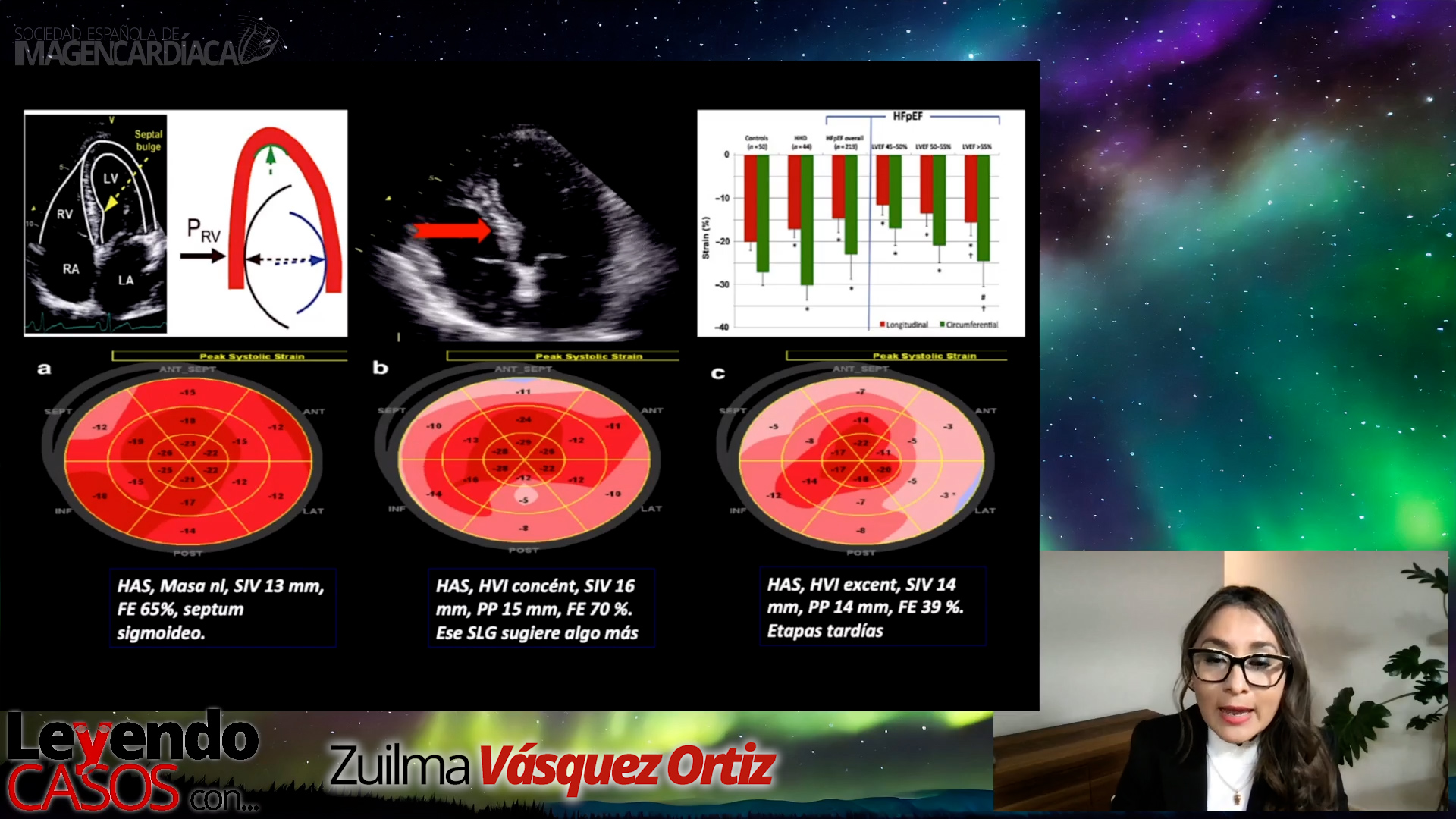 Zuilma Vásquez - Casos de Strain (1)