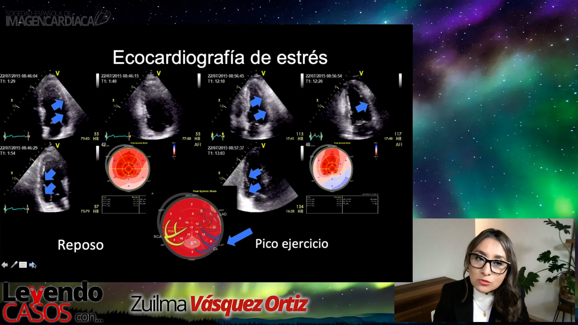 Zuilma Vásquez - Casos de Strain (2)