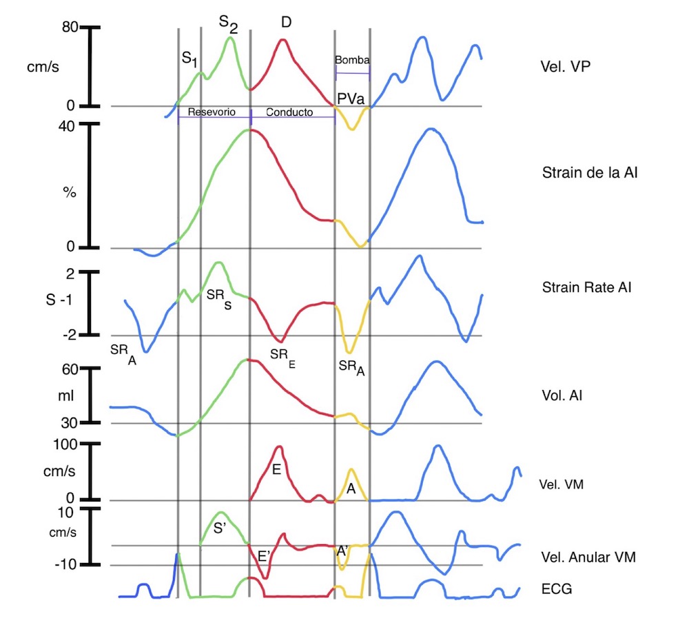 Figura 1. Función de la aurícula izquierda y su color relacionado al ciclo cardiaco (verde, reservorio; rojo, conducto; amarillo, bomba). Graficados están la velocidad de venas pulmonares (VP), Strain y Strain Rate de la AI, Volumen de la AI, doppler espectral transmitral y doppler tisular del anillo mitral. (adaptado de (21)).