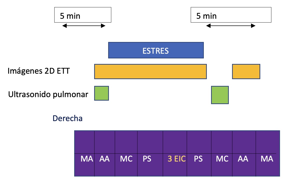 Figura 2. 4 sitios de escaneo pulmonar + ecocardiograma transtorácico durante el estrés.