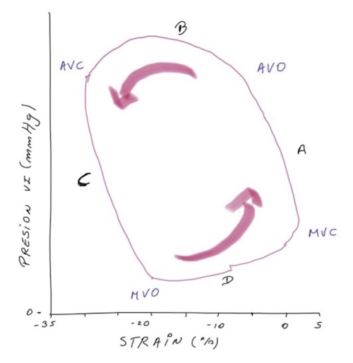 Figura 8. Diagrama del bucle presión-strain. Relación entre la presión del VI y la deformación longitudinal global durante el ciclo cardíaco en un corazón normal. Después del cierre de la válvula mitral, se produce un rápido aumento de presión del VI, con un cambio mínimo en el strain durante la contracción isovolumétrica. La eyección del ventrículo conduce a un aumento significativo del SLG (cada vez más negativo), la presión del VI continúa creciendo gradualmente, hasta que alcanza su punto más alto y después comienza a disminuir. Con el cierre de la válvula aórtica, se inicia la relajación isovolumétrica: la presión del VI desciende rápidamente con pocos cambios en el SLG pico. La sangre fluye hacia el ventrículo, primero en la fase de llenado ventricular temprano, diástasis, finalmente la presión aumenta ligeramente en la sístole auricular, mientras que el strain vuelve a su valor inicial. MVC(cierre de la válvula mitral); AVO(apertura de la válvula aortica); AVC(cierre de la válvula aortica); MVO(apertura de la válvula mitral); А(contracción isovolumétrica); B(eyección ventricular); C(relajación isovolumétrica); D(llenado ventricular).