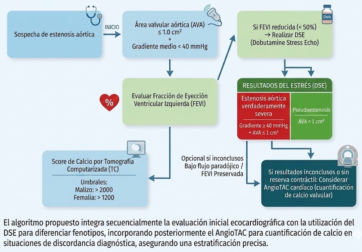Algoritmo diagnóstico en estenosis aórtica de bajo gradiente. (Elaboración propia).