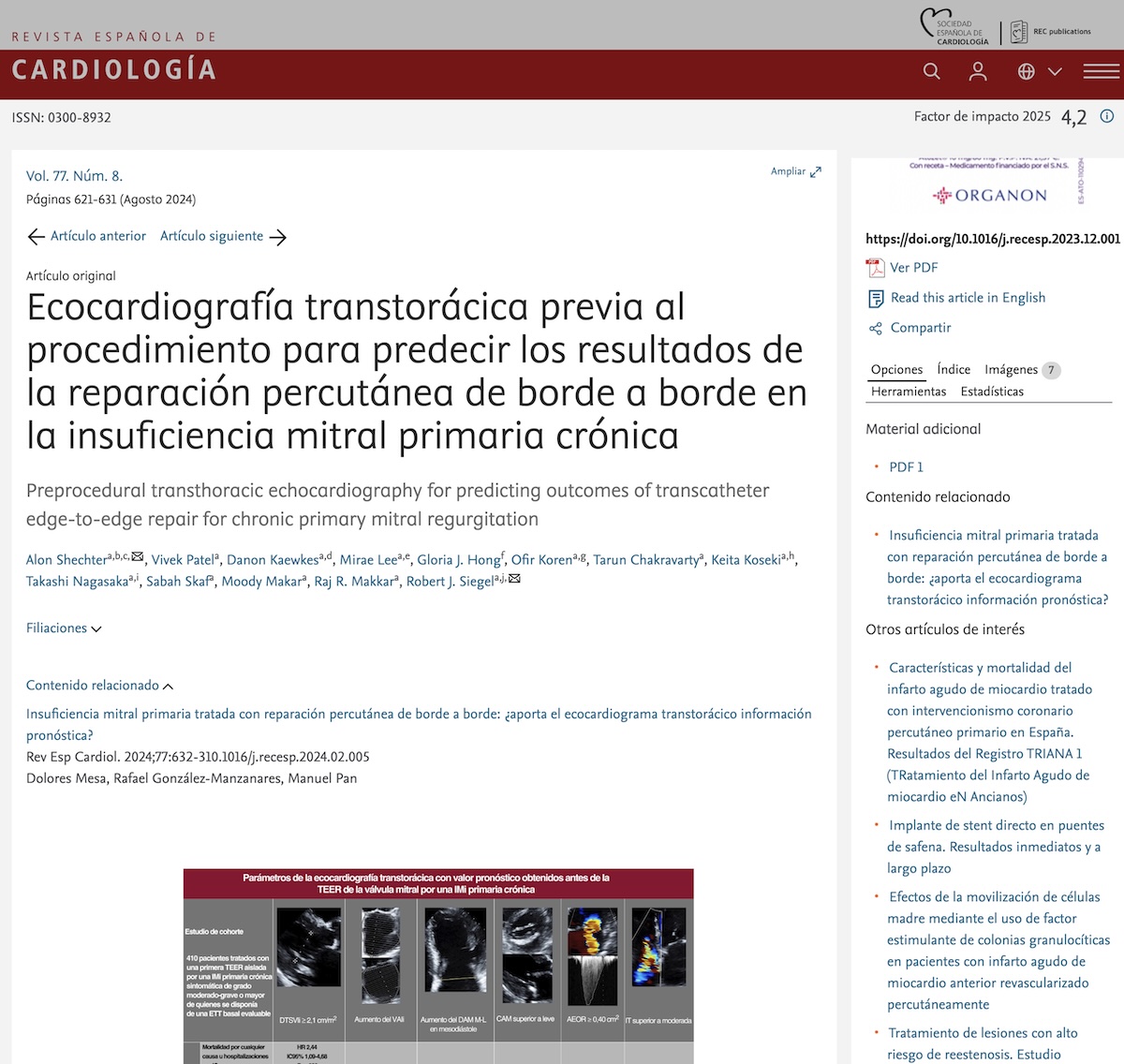 Ecocardiografía transtorácica previa al procedimiento para predecir los resultados de la reparación valvular percutánea borde a borde en insuficiencia mitral primaria crónica