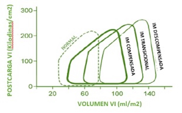 Figura 9. La porción fibrosa del anillo mitral está anatómicamente relacionada con la porción membranosa del septo interventricular. El resto del anillo está compuesto por tejido adiposo y discurre a lo largo de la pared libre del ventrículo derecho. La dilatación del anillo se limita a la pared libre del Ventrículo derecho.