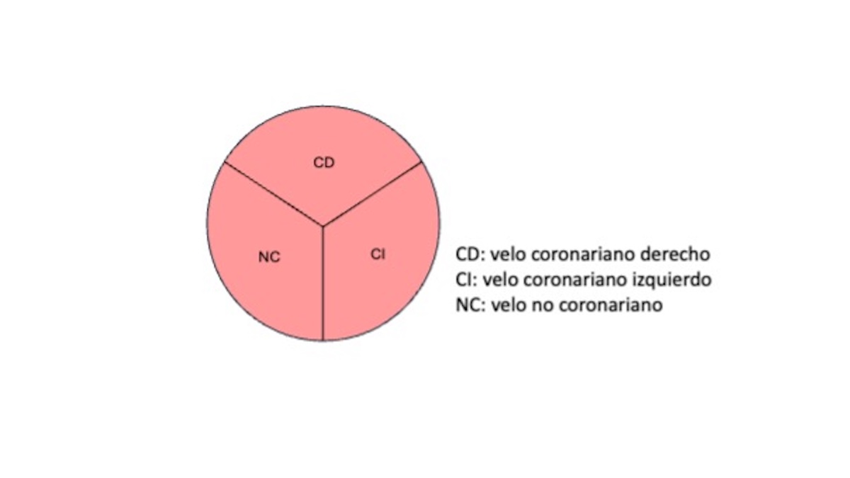 Fig 1. Visión esquemática de la válvula aórtica en plano paraesternal eje corto de ecocardiograma transtorácico