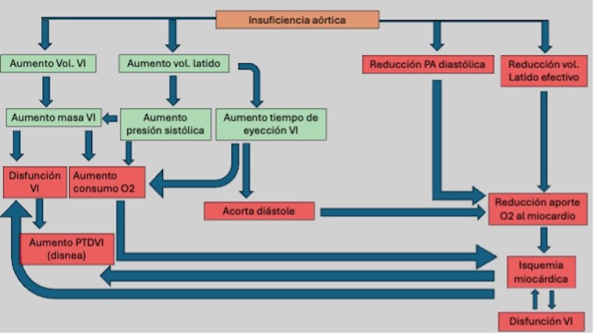 Figura 2. Fisiopatología de la insuficiencia aórtica crónica