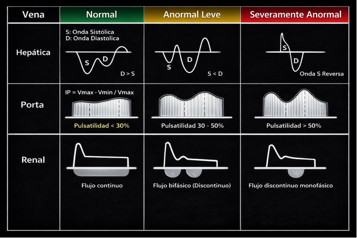 Figura 4. Patrones Doppler venosos en la clasificación VExUS.