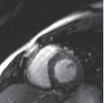 Figura 11