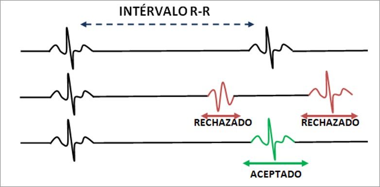 Figura 14