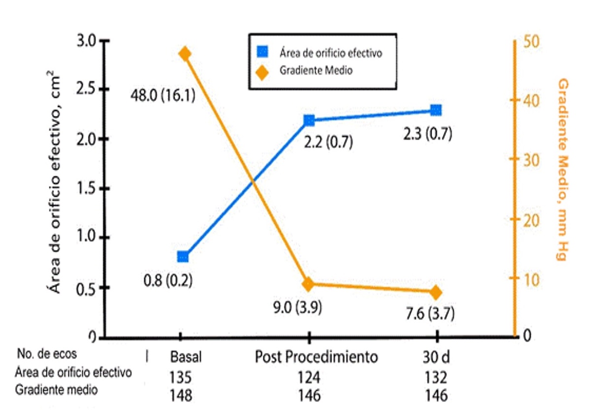 FIGURA 6 Hemodinamia de la válvula (Gradiente medio valvular aórtico y área del orificio efectivo).