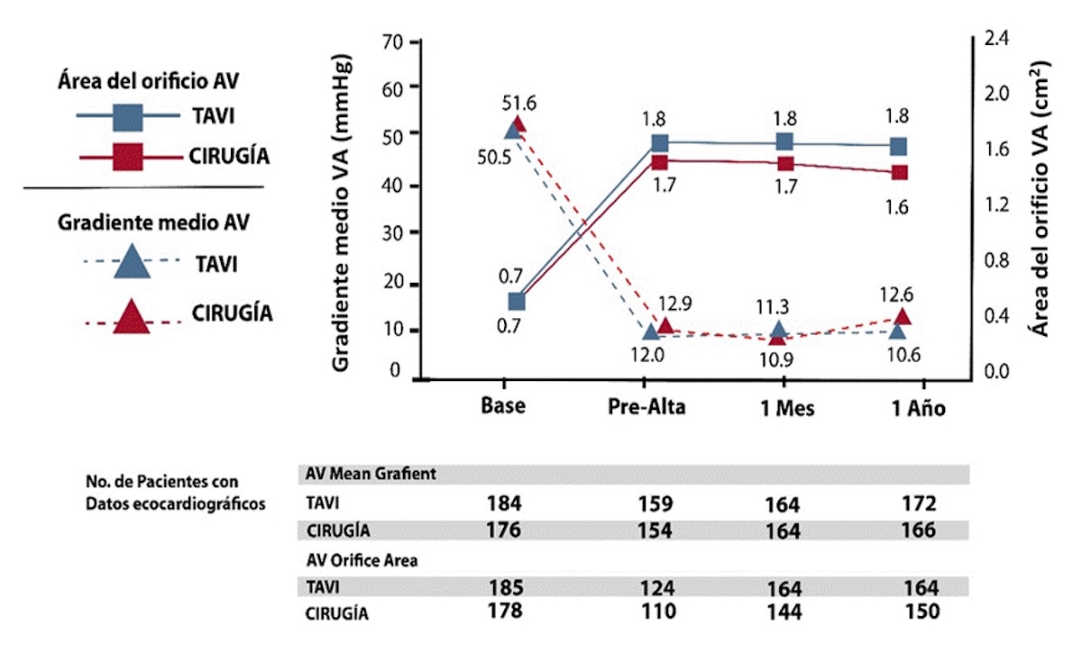 Figura 13 Perfil hemodinámico valvular en el notion 2.