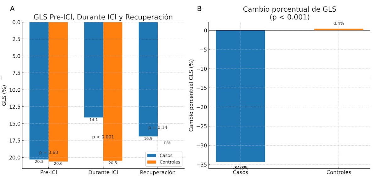 Figura 1. Evolución y deterioro funcional del strain longitudinal global (GLS) en pacientes con miocarditis inducida por ICIs. Panel A: Comparación del GLS en pacientes con miocarditis antes del inicio del tratamiento inmunoterapéutico (Pre-ICI), durante el episodio agudo (Durante ICI) y tras la inmunosupresión (Recuperación), en comparación con controles. El GLS disminuyó significativamente durante la toxicidad (p < 0.001), con una recuperación parcial posterior (p = 0.14) que no alcanzó los valores basales. Panel B: Cambio porcentual del GLS desde la fase basal hasta el episodio agudo. Los pacientes con miocarditis mostraron una reducción media del 34.3%, frente a una variación mínima en controles (0.4%), con significación estadística (p < 0.001).