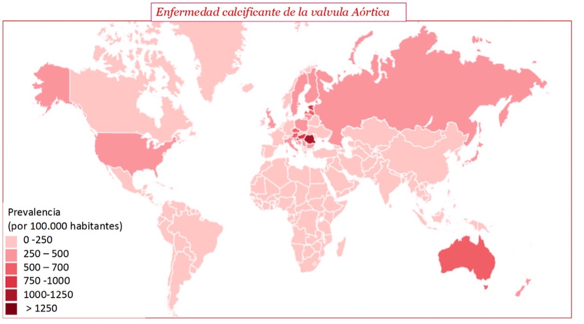 Figura 1. Prevalencia de la Enfermedad Calcificante de la Válvula Aórtica  Fuente: tomado, adaptado y traducido de referencia 8: Coffey S, et al. Global epidemiology of valvular heart disease. Nat Rev Cardiol. 2021 Jun 25. Doi: 10.1038/s41569-021-00570-z