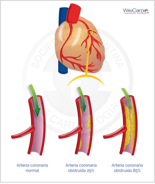 Figura 2