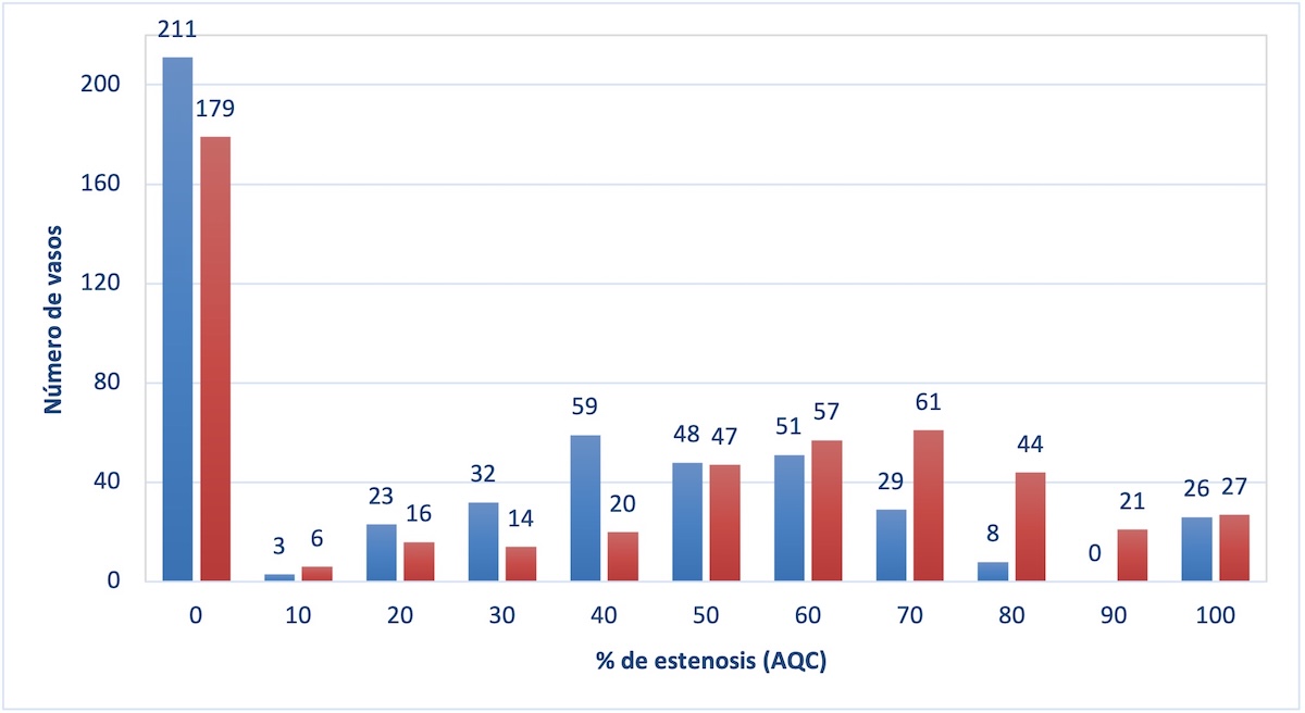 Figura 3: Porcentaje de estenosis en términos de AC según la modalidad (angiografía en azul y angiografía coronaria continua en rojo). Angiografía coronaria continua: angiografía por tomografía computarizada coronaria; angiografía coronaria cuantitativa (ACC); angiografía coronaria cuantitativa