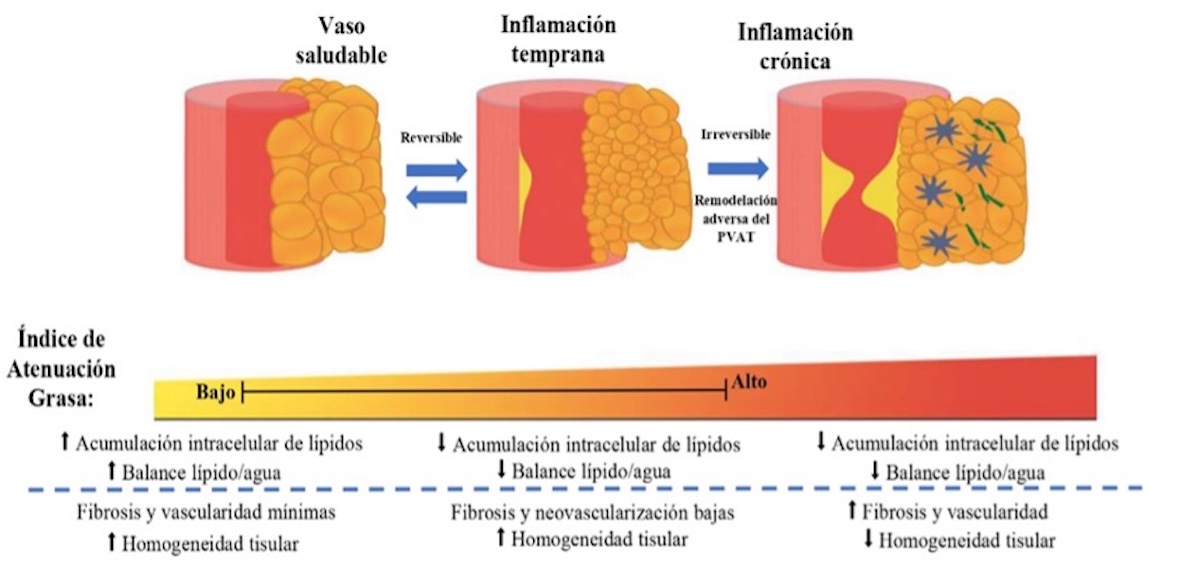 Anexo 6. Análisis del índice de atenuación grasa (FAI) del PVAT. Eur Heart J. 2019 Nov 14;40(43):3529-354.