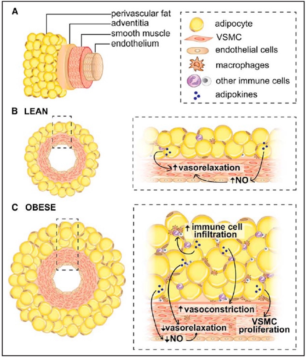 Figura 9: TAPV y regulación del tono vascular. En condiciones esbeltas las adipoquinas inducen relajación por mecanismos que implican óxido nítrico. La obesidad reduce éstas y se incrementan las que inducen vasoconstricción e inflamación. Reproducida de ref. 27 con permiso de Wolter Kluwer Health.