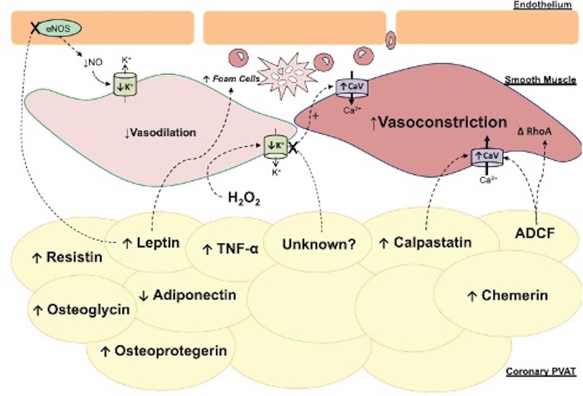 Figura 10. Diagrama de la interacción del TAPC con la pared vascular. Destacan la inhibición de la eONS y menor disponibilidad de óxido nítrico, menor vasodilatación o incluso vasoconstricción paradójica. La calpastina y otros mediadores producen vasoconstricción vía canales Cav1.2, y aumenta proteínas osteogénicas. Reproducido con permiso de Wolters Kluwer Health de ref. 29.   Reproducido
