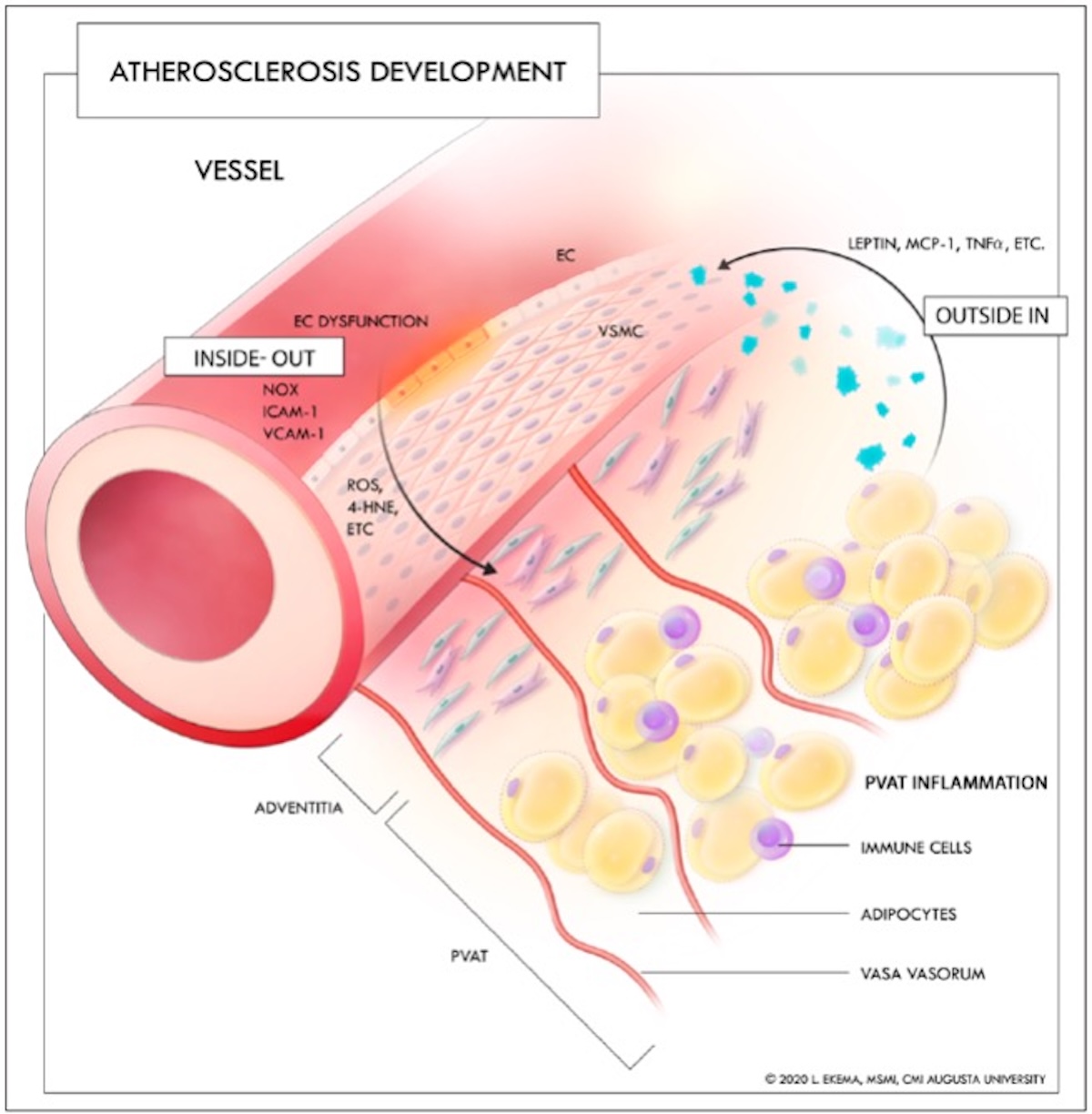 Figura 11. Se ilustra el paso de moléculas con potencial inflamatorio por difusión o facilitado por la vasa vasorum tanto desde la superficie endotelial hacia el TAPC como en sentido inverso. Reproducido de ref. 30 con permiso de Wolter Kluwer Health.
