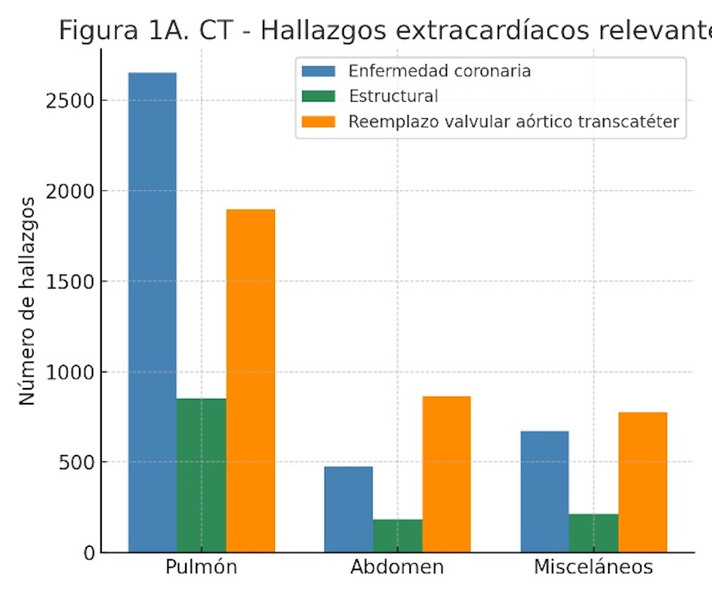 Figura 1A: Gráfico de barras del número de hallazgos extracardíacos clínicamente relevantes, agrupados por región corporal e indicación del examen, en (A) estudios de TC cardíaca y (B) estudios de RM cardíaca.
