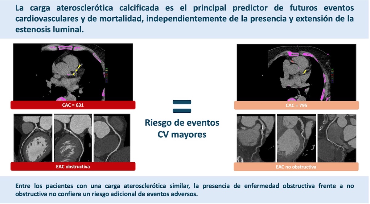 Figura 2. Riesgo de eventos cardiovasculares mayores en pacientes con carga aterosclerótica calcificada similar.