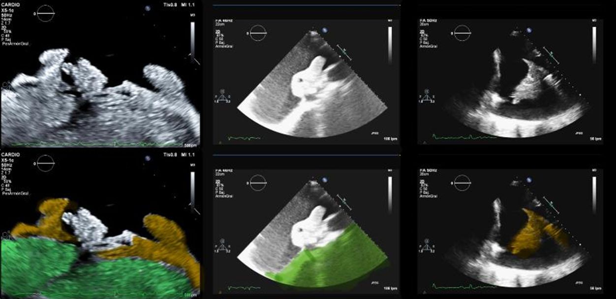 35