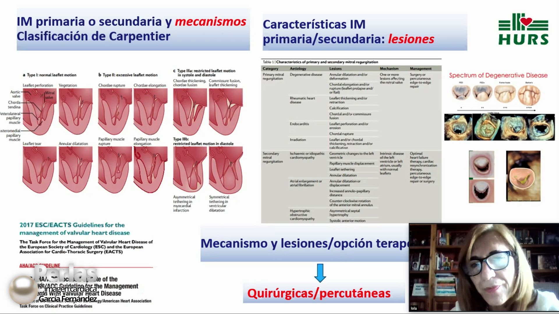 Lo último sobre la Insuficiencia Mitral