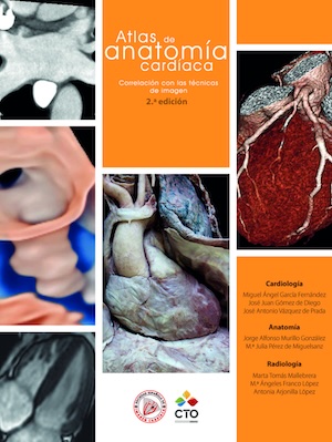 Atlas de anatomía cardíaca