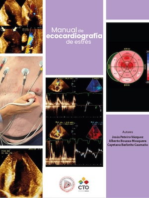 Manual de ecocardiografía de estrés
