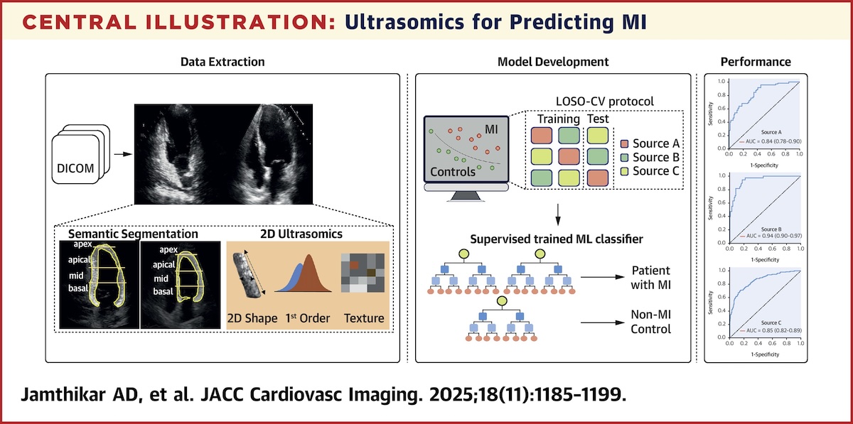 Análisis de textura ultrasónica para la predicción del infarto agudo de miocardio