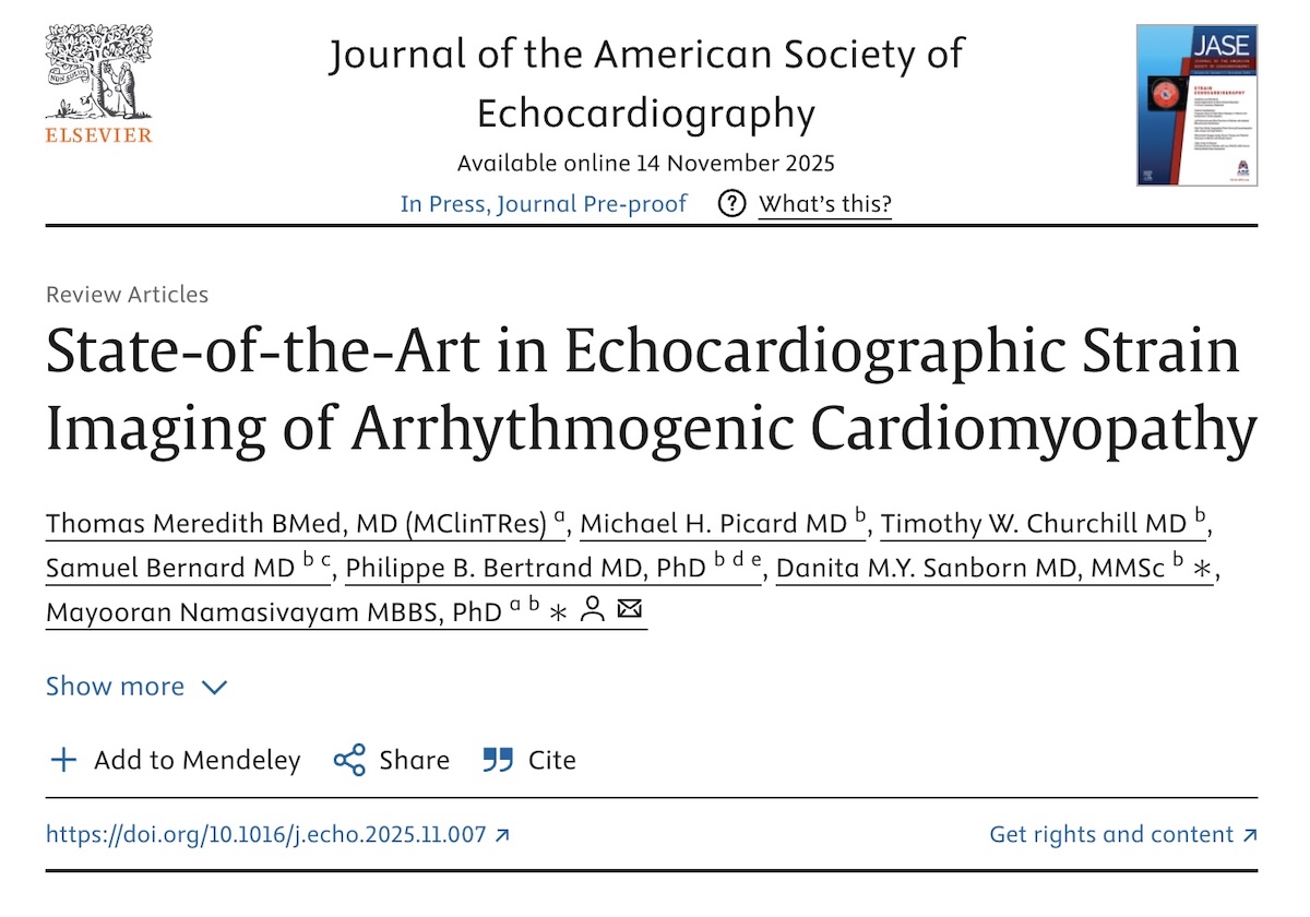 Estado del arte en la imagen de deformación ecocardiográfica de la miocardiopatía arritmogénica