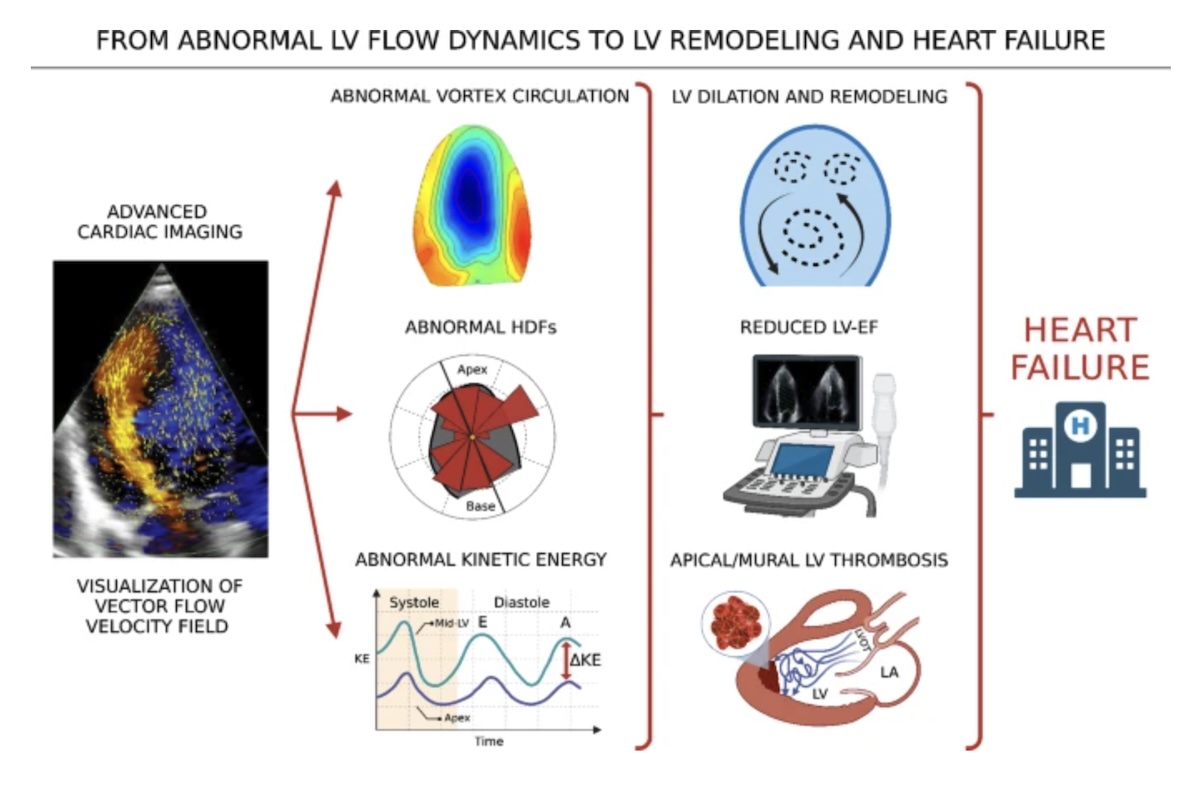 Dinámica del flujo ventricular izquierdo con técnicas de imagen cardíaca en pacientes con insuficiencia cardíaca: estado del arte