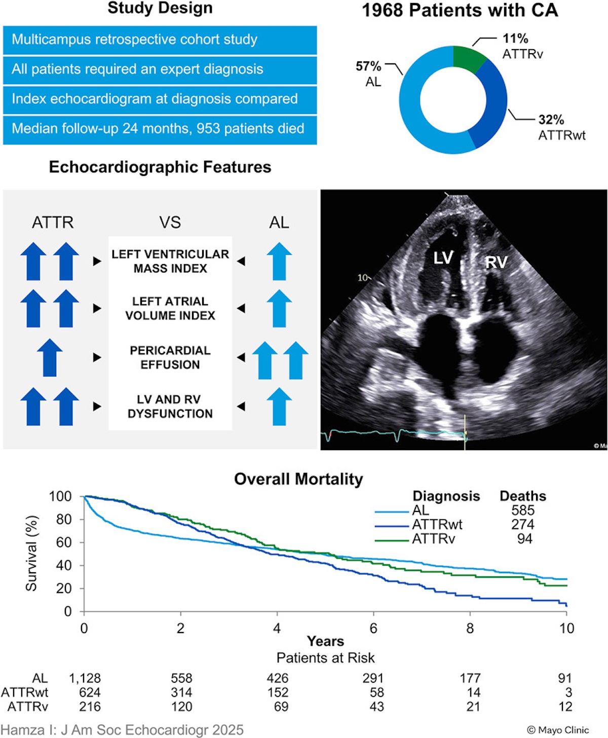 Diferencias fenotípicas ecocardiográficas entre la amiloidosis cardíaca por cadenas ligeras y por transtirretina y su relación con el pronóstico