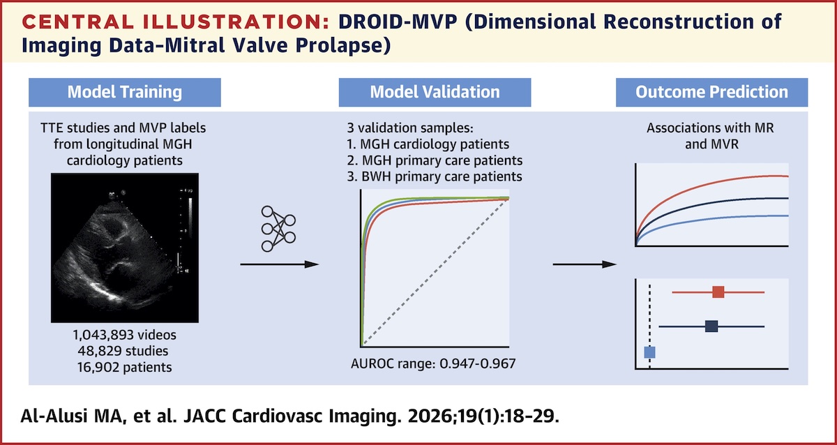'Deep learning' en el diagnóstico con ecocardiografía de prolapso mitral