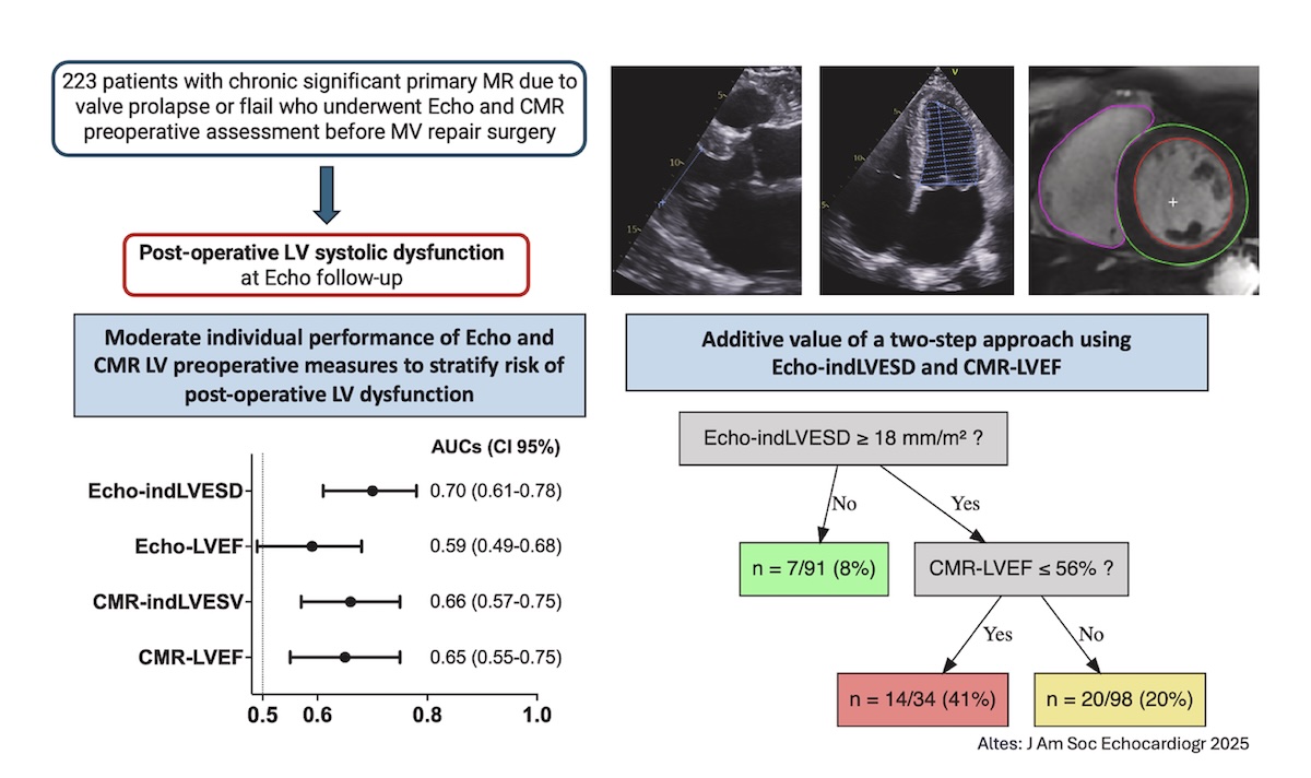 Disfunción postoperatoria del ventrículo izquierdo en la insuficiencia mitral primaria: Uso de la resonancia magnética cardíaca y la ecocardiografía preoperatorias