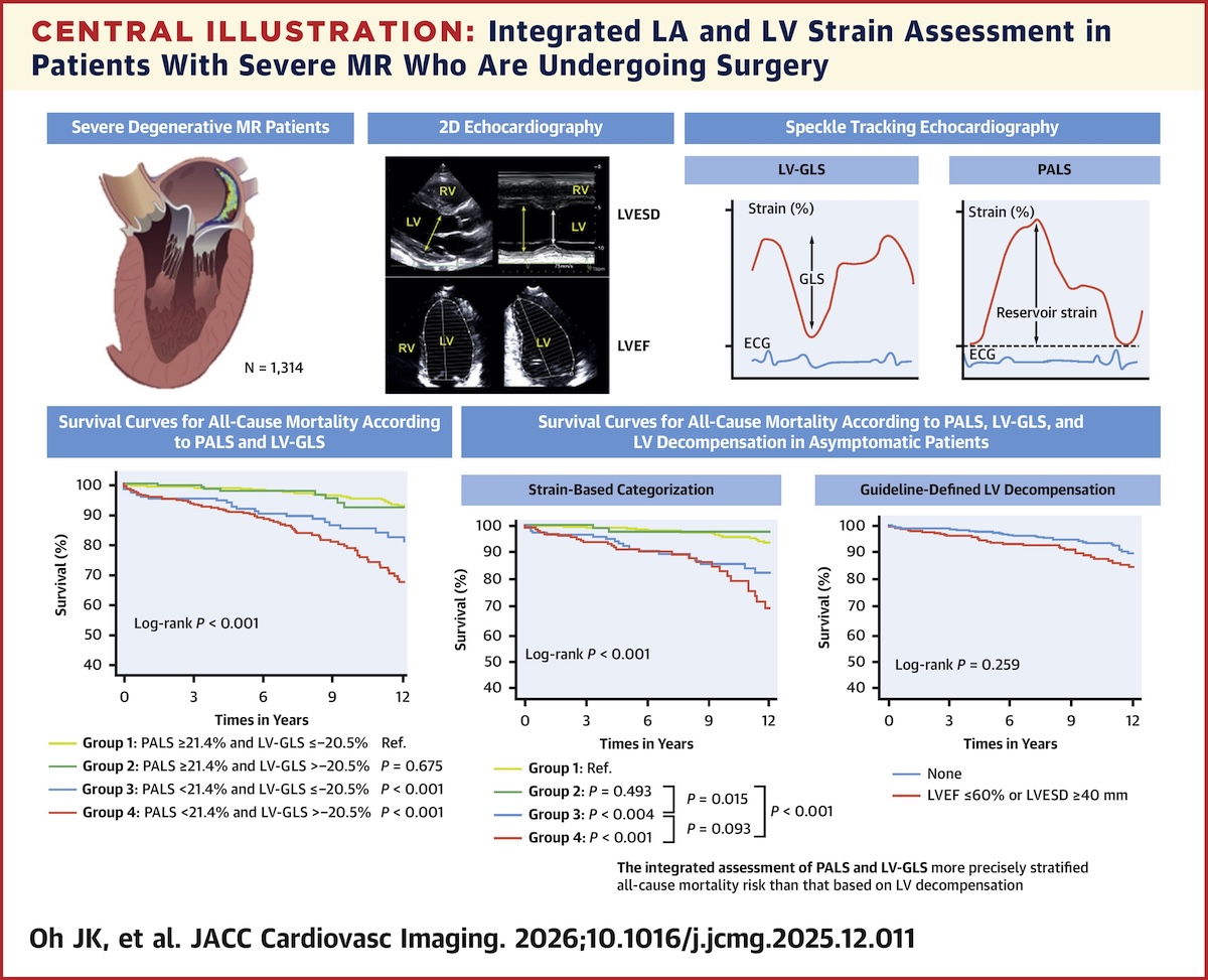 Evaluación integrada del strain auricular y ventricular en pacientes con insuficiencia mitral degenerativa severa sometidos a cirugía
