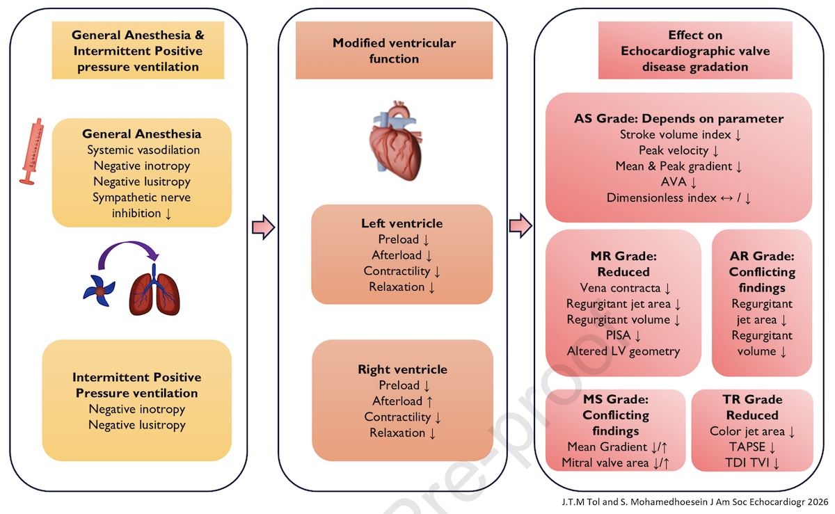 El efecto de la anestesia general y la ventilación mecánica en la evaluación ecocardiográfica de la función cardíaca