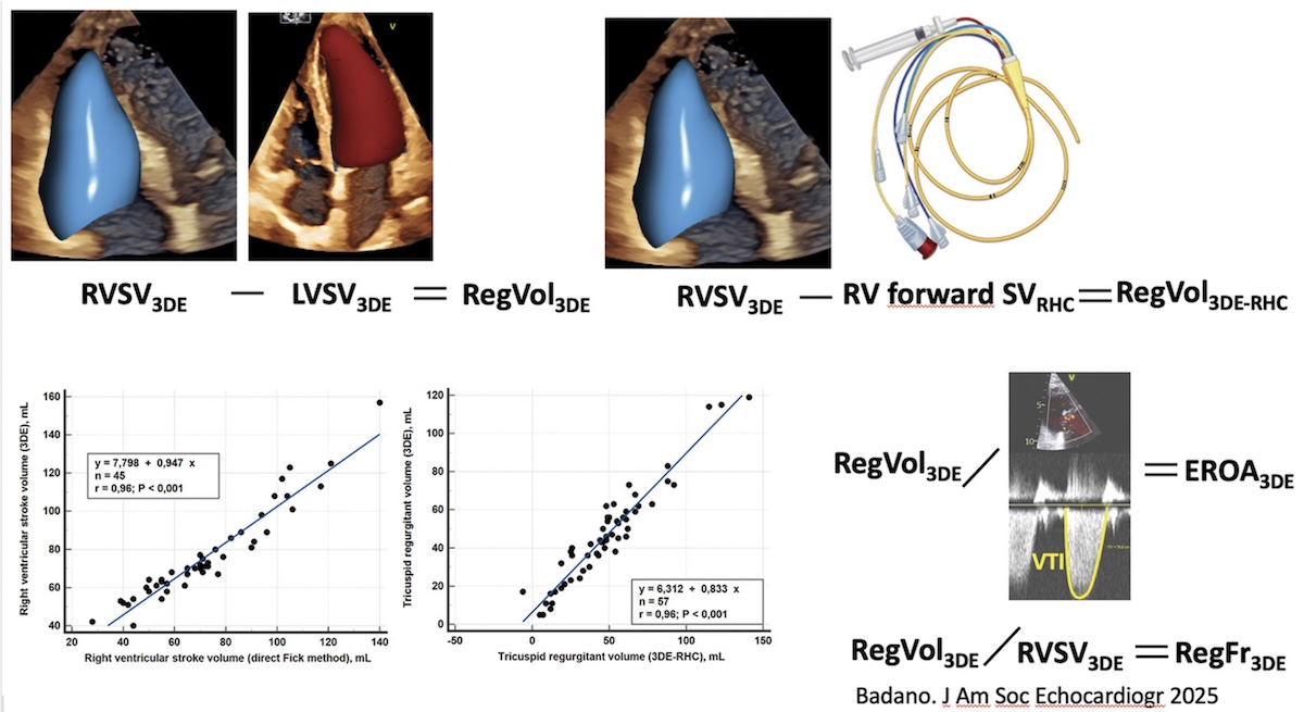 Validación invasiva del volumen sistólico del ventrículo derecho y del volumen regurgitante tricúspideo obtenidos mediante ecocardiografía tridimensional