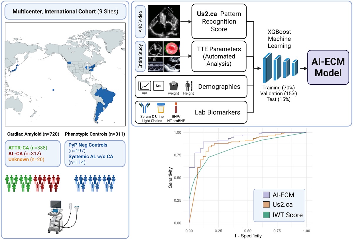 Mejora de la detección de la amiloidosis cardiaca con inteligencia artificial: integración de la ecocardiografía con datos clínicos y analíticos